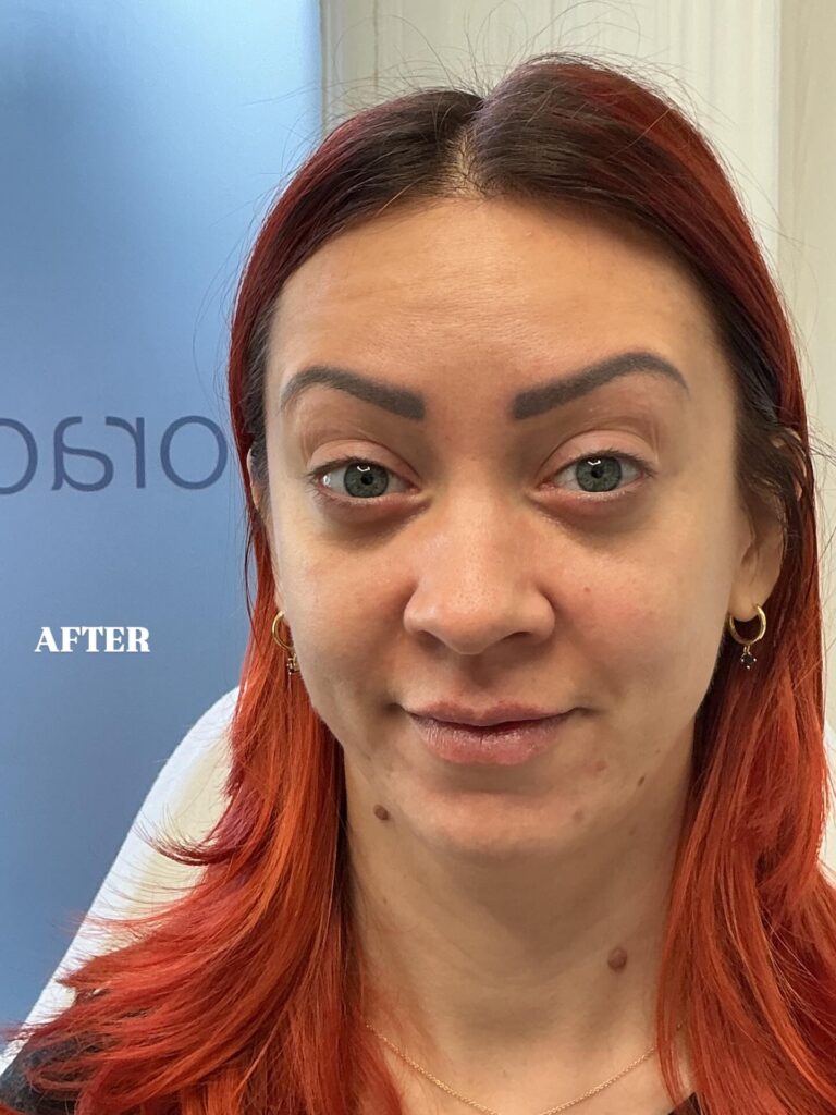 Dr Ali After 768x1024