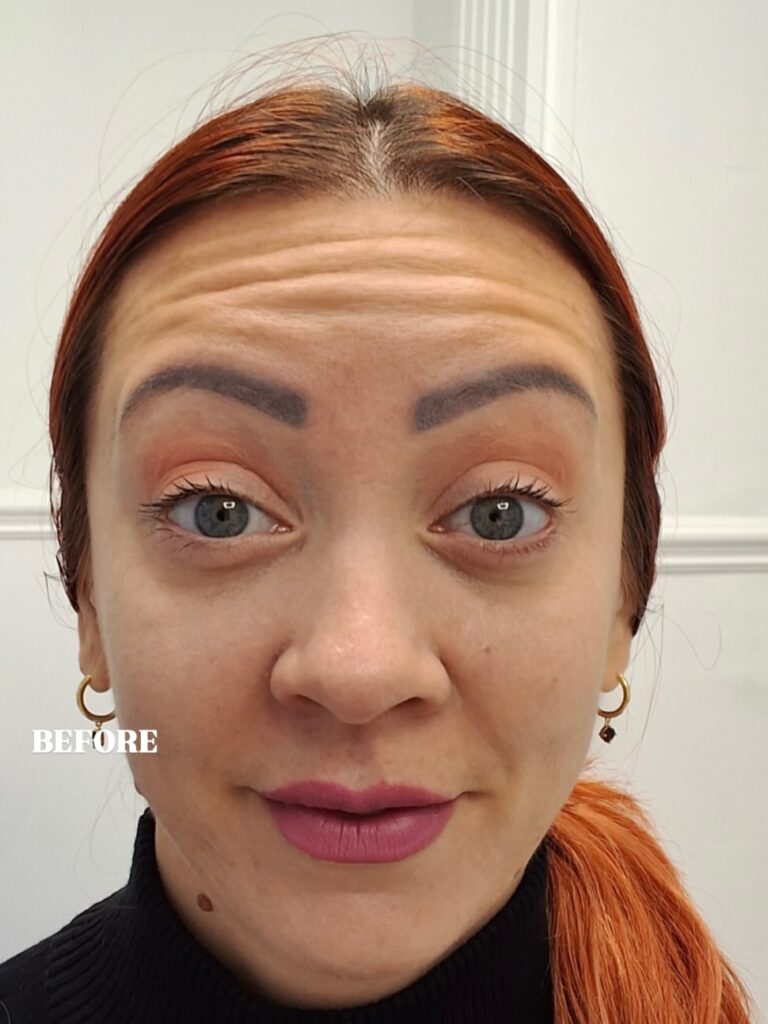 Dr Ali Before 768x1024