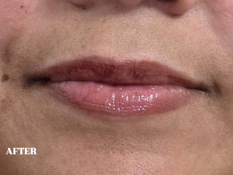 Dr Ali lips after 768x576